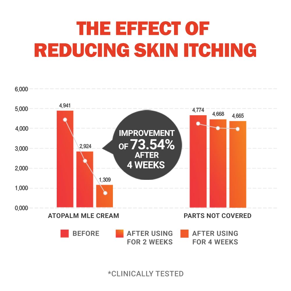 ATOPALM | MLE Eczema Cream | Premium Baby Face Cream | Body Moisturizer for Skin Barrier | Baby Lotion for Relieving Itchiness & Redness | Eczema Cream for Sensitive Skin | 5.6 fl oz (160ml)