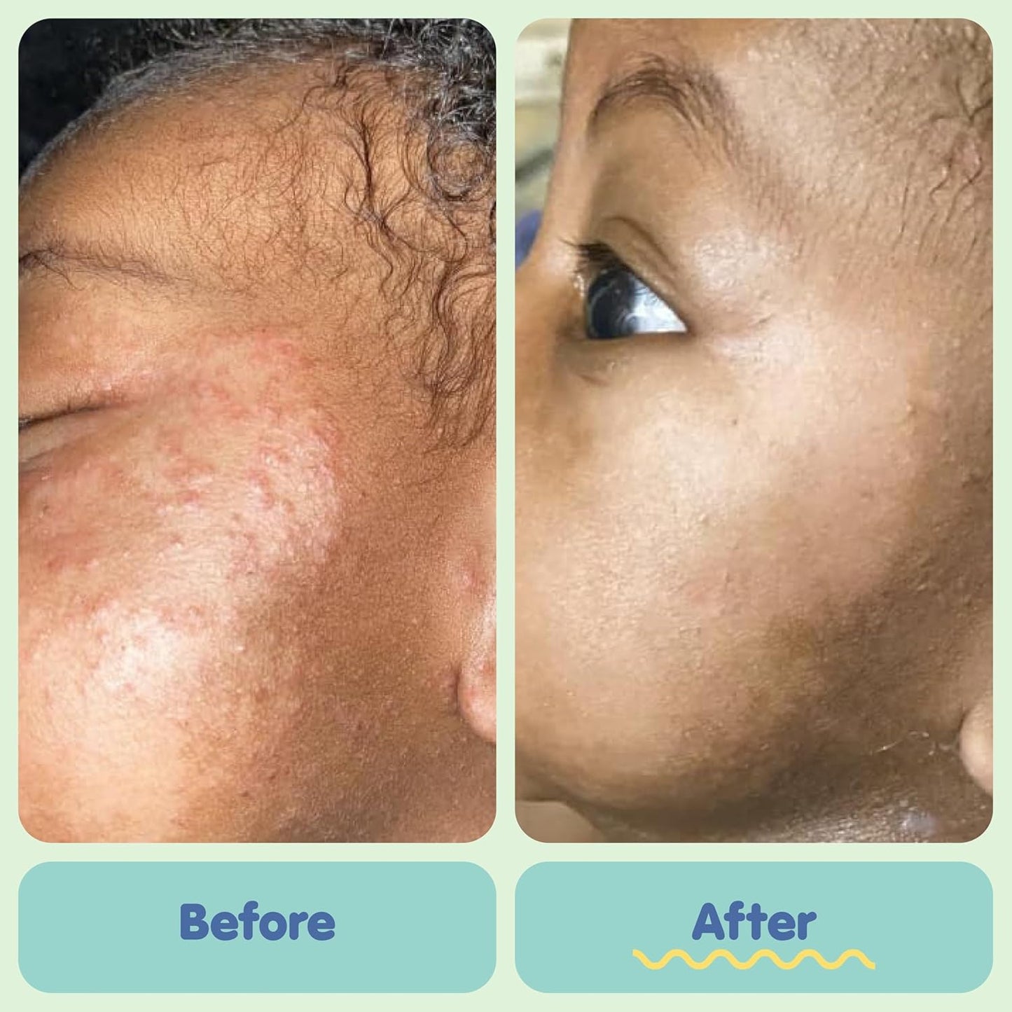 TUBBY TODD Baby Bath & Skincare Kit - The Baby Bundle - Shampoo and Body Wash, Everyday Lotion 8.5 Oz, All Over Ointment 3.5 Oz & Diaper Paste Cream 4 Oz Gift Set - Fragrance-Free