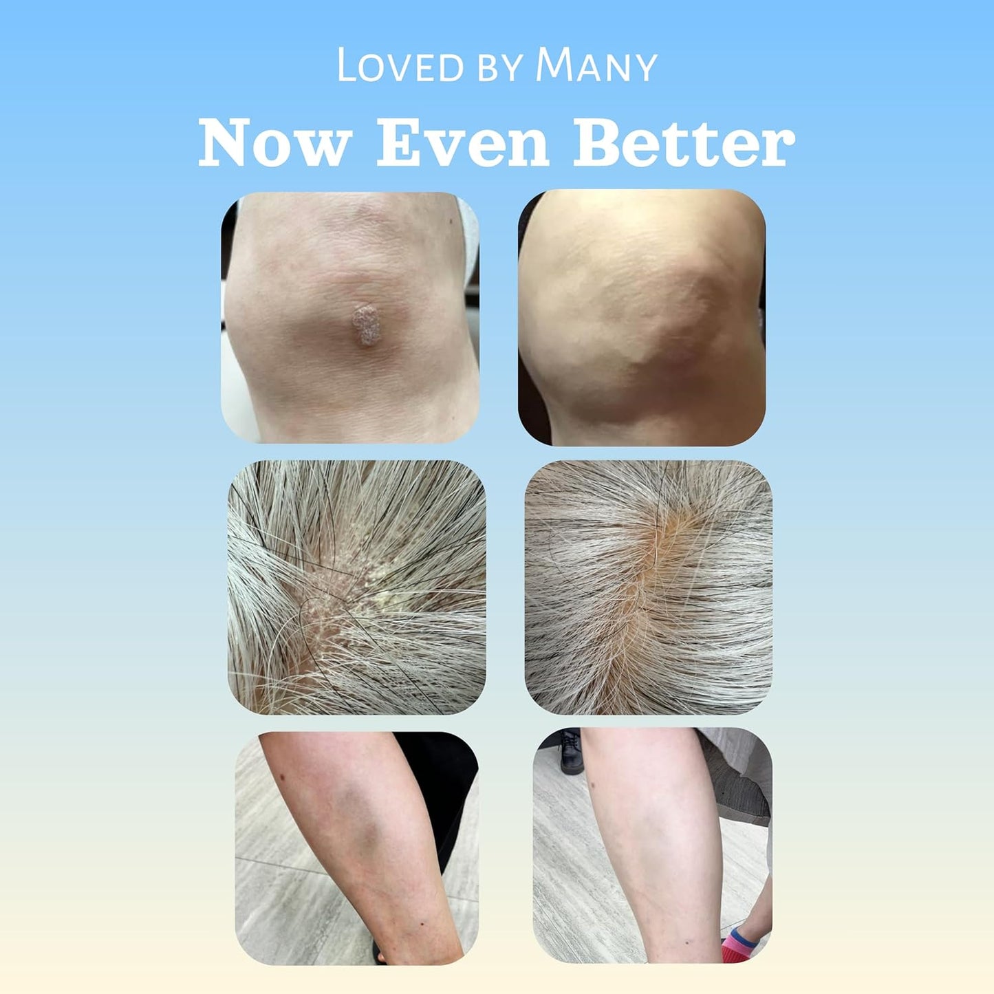 Natural SKIN REPAIR. Clinically tested Aromatherapy. Powerful Essential Oil. Eczema, Dermatitis, Diaper rash, and Sensitive skin. For all skin types. Hypoallergenic, Vegan, Paraben Free. 30ml BOTTLE