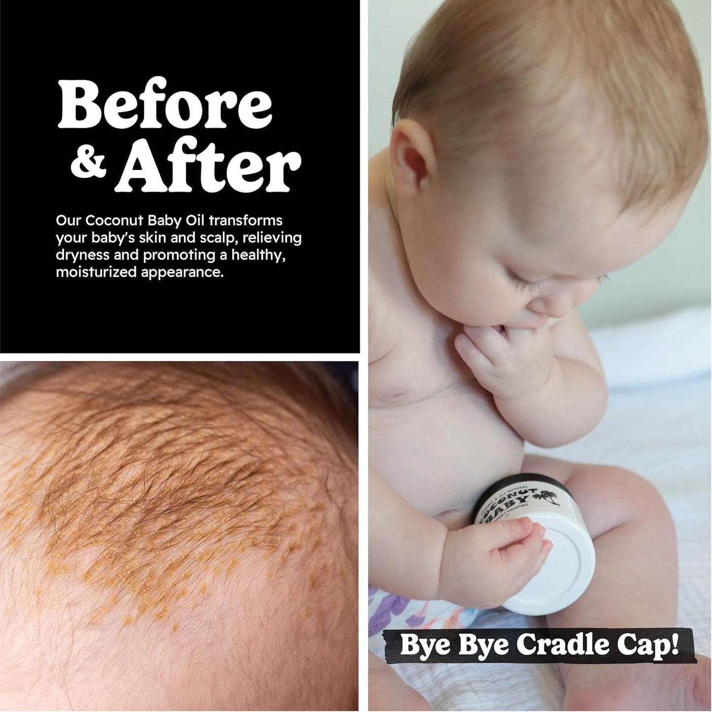 Coconut Essentials COCONUT BABY Oil, Natural & Organic Moisturizer for Newborn Sensitive Skin, Eczema & Psoriasis Relief, Hair Oil for Cradle Cap Treatment, Unscented, Sunflower & Grape Seed 8 fl oz