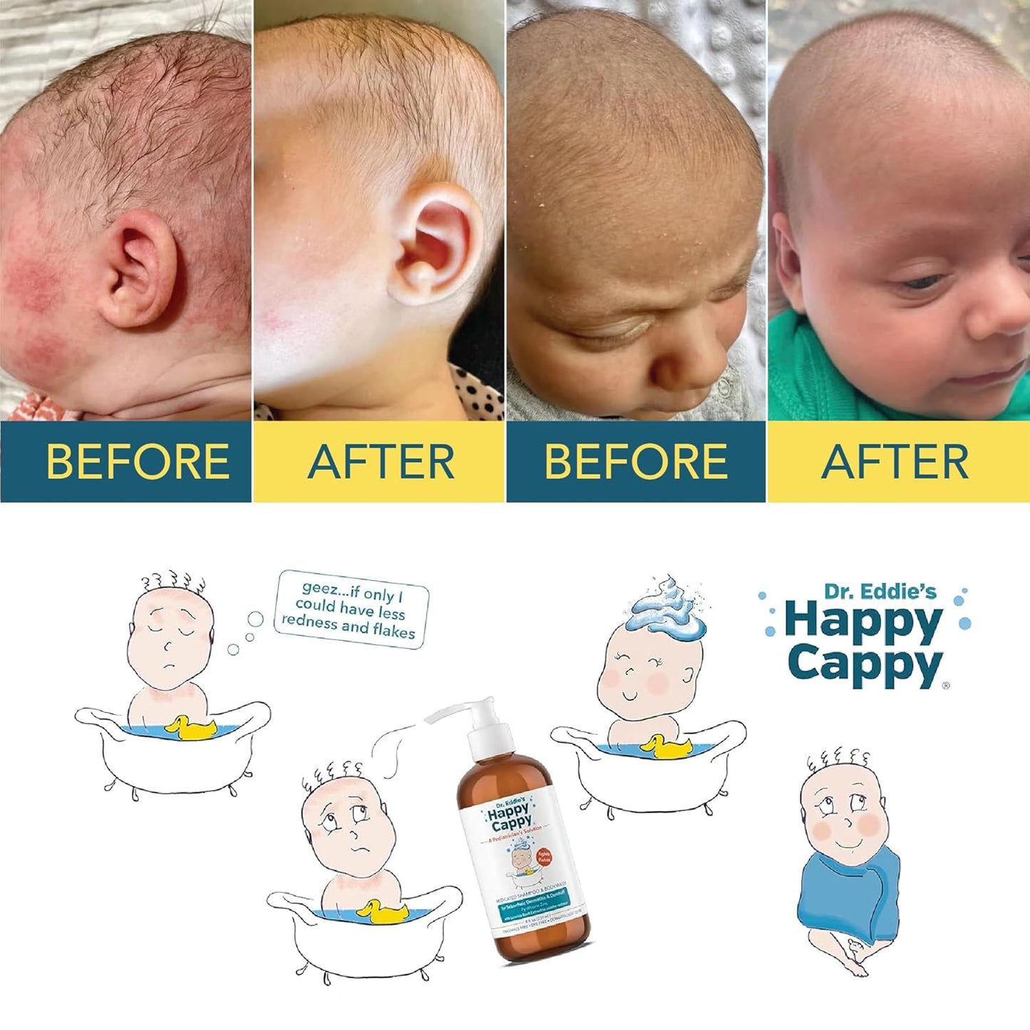Happy Cappy Dr. Eddie’s Medicated Shampoo and Body Wash- Baby Dandruff Shampoo, Helps Cradle Cap and Seborrheic Dermatitis, Reduces Redness, Dermatologist Tested, Fragrance-Free- 8 Fl Oz (Pack of 3)